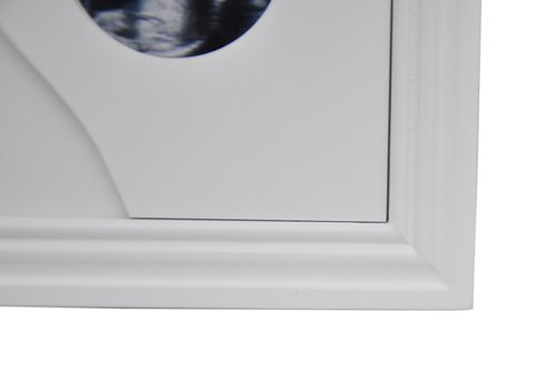 Ramka Galeria na 9 zdjęć w różnych formatach - biała - ciążowa - 1499
